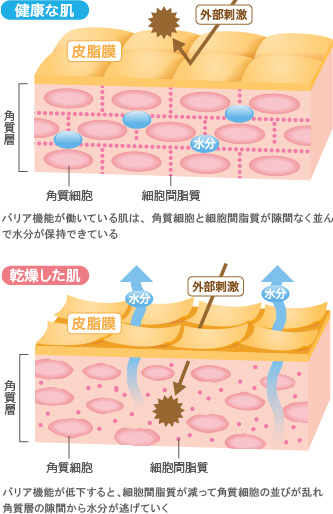 健康な肌と乾燥した肌の比較図