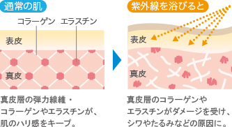 紫外線の影響